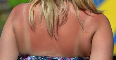 'Red flag' signs of heatstroke to look out for as weather warms up, according to NHS