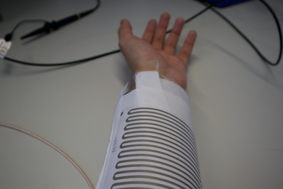 ‘Smart bandages’ could improve outcomes for patients with non-healing wounds