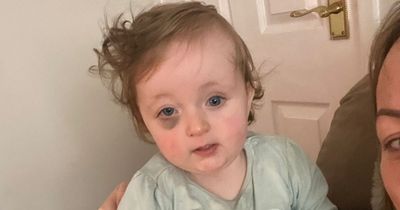 Family rocked at baby's diagnosis after sudden bruise on eye 'gets bigger and bigger'