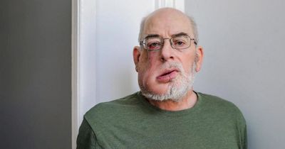'I couldn't get a NHS dentist appointment so went private and it saved my life'
