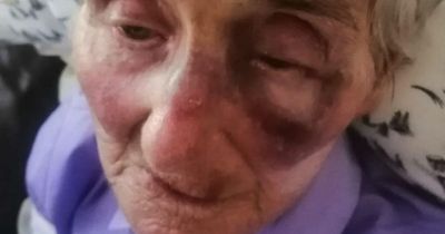 Pensioner left with eye injury after being hit with water balloon in car