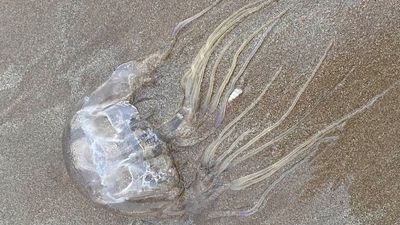 Boy stung by box jellyfish at Darwin's Casuarina Beach, prompting dry season warning