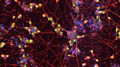 Parkinson’s Drug Shows Promise In Delaying Symptoms Of ALS