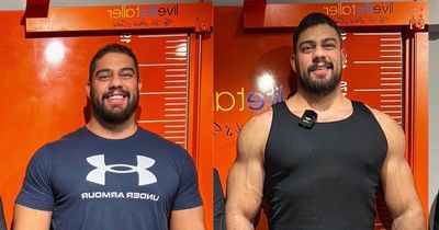 Dad flies to Turkey for £86,000 surgery to make himself seven inches taller