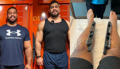 Man has £86,000 surgery to make himself 9 inches taller