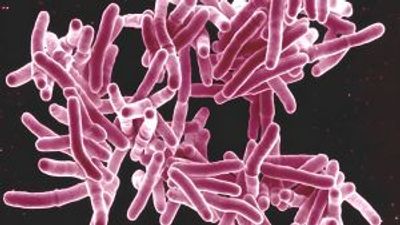 The resurgence of ‘ticking timebomb’ tuberculosis