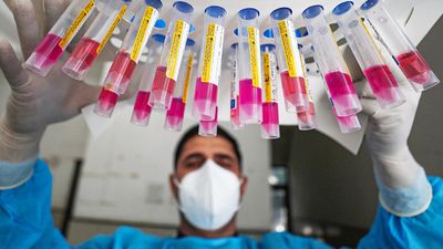 World lived through a pandemic and India played a critical role: WHO scientist