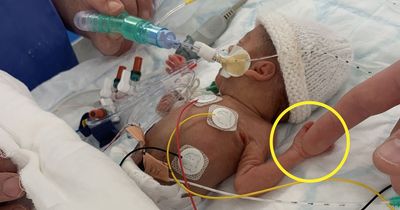 'Miracle' twin babies born at 25 weeks so tiny their hands were too small to clasp dad's finger