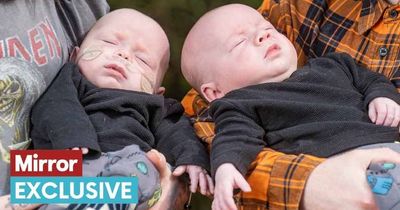 Miracle twin due to be terminated to save his brother makes surprise arrival in loo