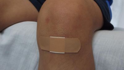 Drugs Controller approves first indigenously developed animal-derived tissue engineering scaffold for skin wounds healing