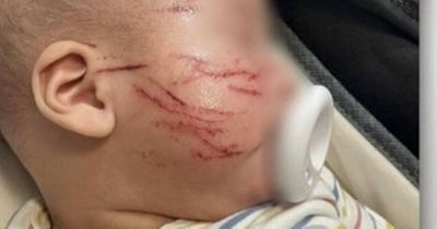 Mum horrified after picking baby up from nursery to find his face covered in scratches
