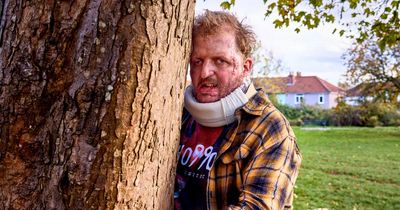 Bristol fire survivor Big Jeff 'embracing' his scars one year after cooking accident