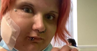 Woman left looking like a 'Teletubby' after brushing past 'UK's most dangerous plant'