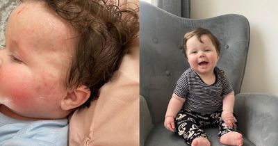 Parents insist £7.99 'miracle in a jar' soothes eczema overnight