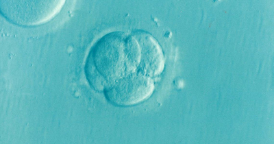 Scientists create human embryo with no egg or sperm