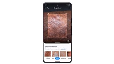 Google Lens will now identify that weird rash for you — here's how