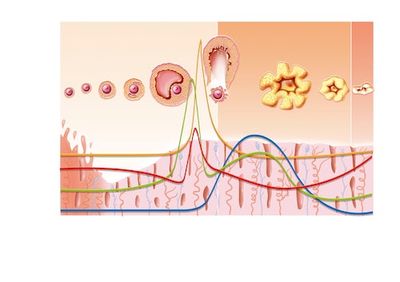 Infection With This Bacteria Could Trigger the Development of Endometriosis