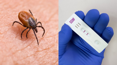 UK scientists warn of 'deadly virus' due to climate change that kills nearly every second patient