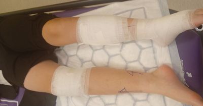 Strangers scoop up schoolboy, 12, as escaped dogs attack