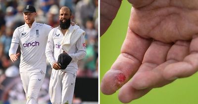 Ben Stokes gamble risks backfiring as Moeen Ali suffers Ashes injury scare