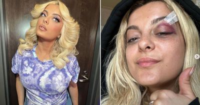 Bebe Rexha shares snaps of gruesome injury after being hit in the face with a phone