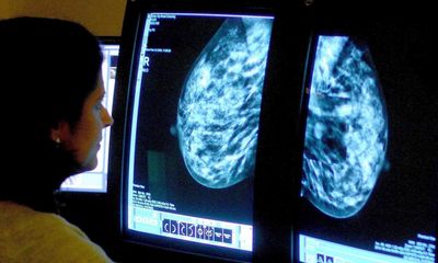 Cancer test and treatment delays in UK have put ‘100,000 lives at risk’ since 2014