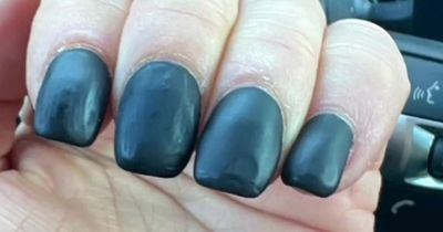 Manicure fail leaves woman looking like she dunked her fingers in 'olive jar'