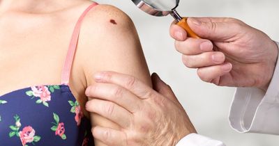 Five skin cancer red flags everyone should know and how to spot them before it's too late
