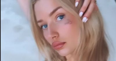 Celebs Go Dating star Lottie Moss shares 'sad' update with fans