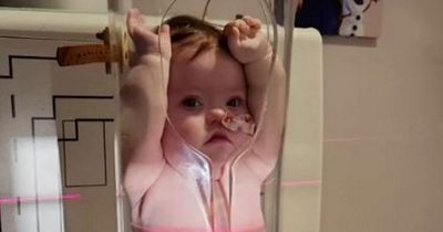 Baby has to be squeezed into clear tube to have X-ray