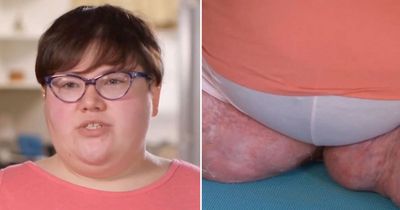 Woman with rash 'that smells like hot garbage' forced to get help from Dr Pimple Popper