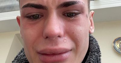 'I spent £3k on Turkey teeth that went wrong - I now look like a shark in a horror movie'