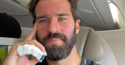 Alisson injury explained as Liverpool star sparks concern with Instagram post