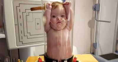 Mum left in stitches after baby girl is squeezed into glass tube for X-ray