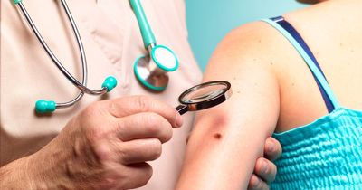 Skin cancer warning signs and how to spot 'red flag' symptoms, according to medical experts