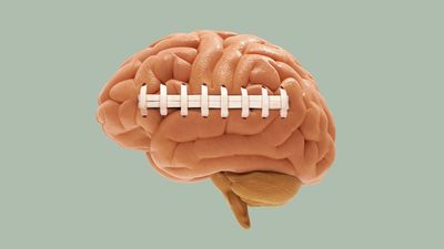 Study: Cumulative force of impacts — not concussions — predicts CTE