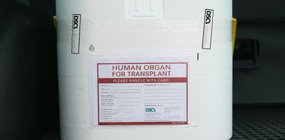 Human organs for transplant: 5 steps Africa must take to improve the supply chain