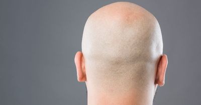 Baldness breakthrough to stimulate hair growth as new treatment found