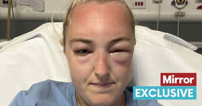'I had no idea you could have an allergic reaction to the sun until my face blew up'