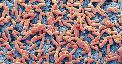 What are the signs and symptoms of E.coli and when to go to a doctor