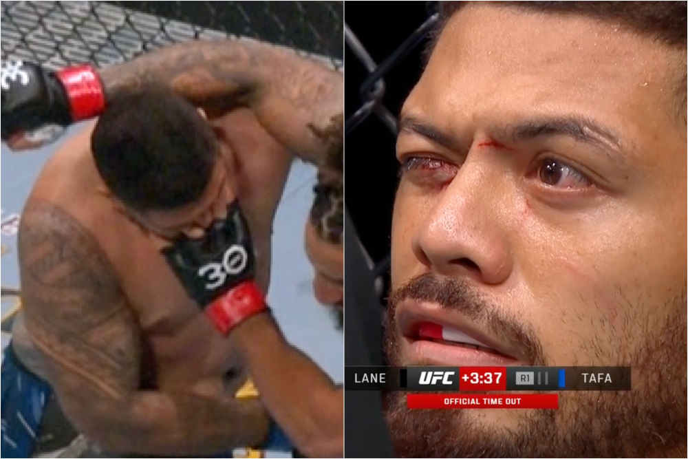 UFC on ABC 5 video Grotesque poke leads to bleeding…