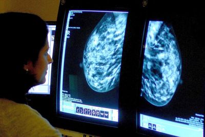 Breast cancer: Signs, symptoms and how to check yourself at home