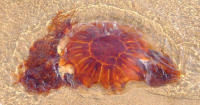 Jellyfish beach warning as mum suffers 'worst pain of life' after being stung