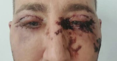 The X Factor's Chris Maloney supported as he admits 'he's gone too far' and shares shock snap