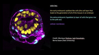 Human embryo model created from stem cells could help understand why some pregnancies fail