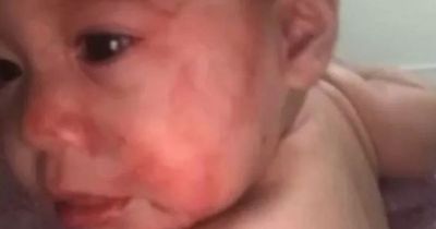 Baby left 'blinking blood' after rock thrown through window showering her in glass