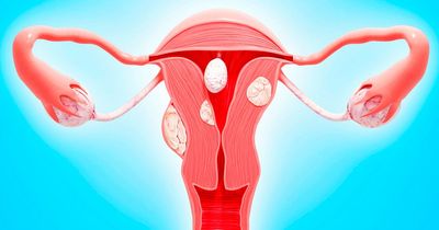 Uterine cancer deaths could soon outnumber deaths from ovarian cancer, oncologist says