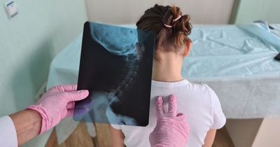Girl waiting five years for scoliosis surgery 'could not breathe at times'