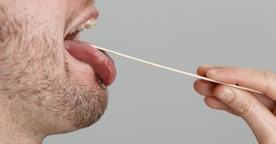 'Sneaky' tongue change could be sign of vitamin deficiency that may cause blood disorder