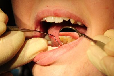 Dentist leaders hit out at government plans to ‘handcuff’ graduates to NHS work
